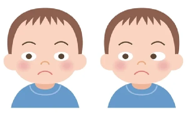 Secondary and Consecutive Esotropia